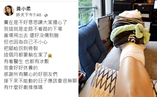 黄小柔脚拐到骨裂，晒出伤势照。（图／翻摄自黄小柔脸书）