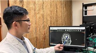 不是中風！婦臉歪嘴斜、口齒不清 竟是1病毒害的