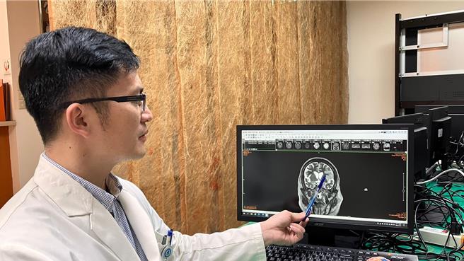 感染科主任黃駟榮醫師指出腦炎的位置。（院方提供／李京昇台中傳真）