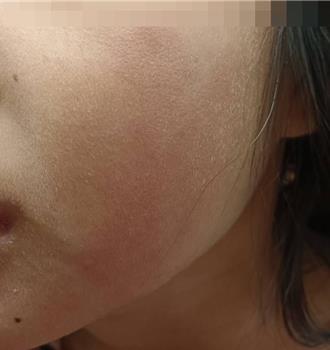 伊甸基金會嘉義早療中心爆不當管教    市府 ：若涉兒虐最高罰60萬