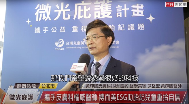 過去的胎記治療有時候難以達到很好療效，但現在以科技的雷射方式治療胎記，可更加穩定的治療皮膚問題。（圖片來源/截自中時新聞網頻道）