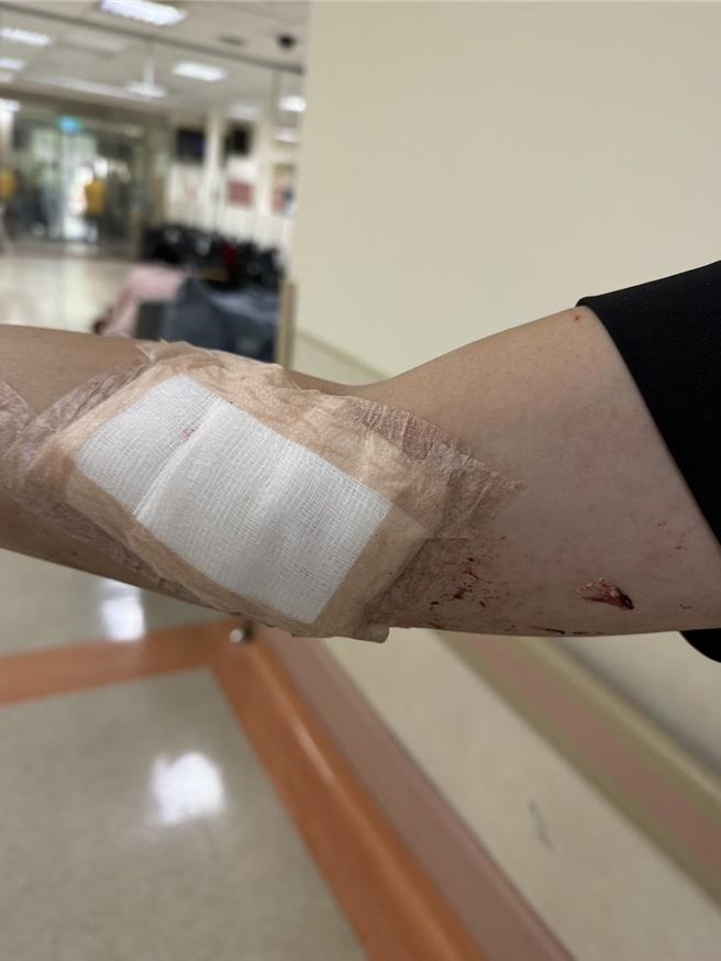 值日小组林、郑姓侦查佐2人手部、脸部割伤，送高医包扎缝合，目前已返队休养。（民眾提供／纪爰高雄传真）