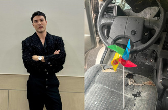 鳳小岳火燒車曝悽慘現況「傷爛了」表演巧遇斷弦　他吐心聲