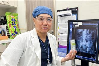 肛門塞罐裝飲料卡5天 醫「打開拉環」取出