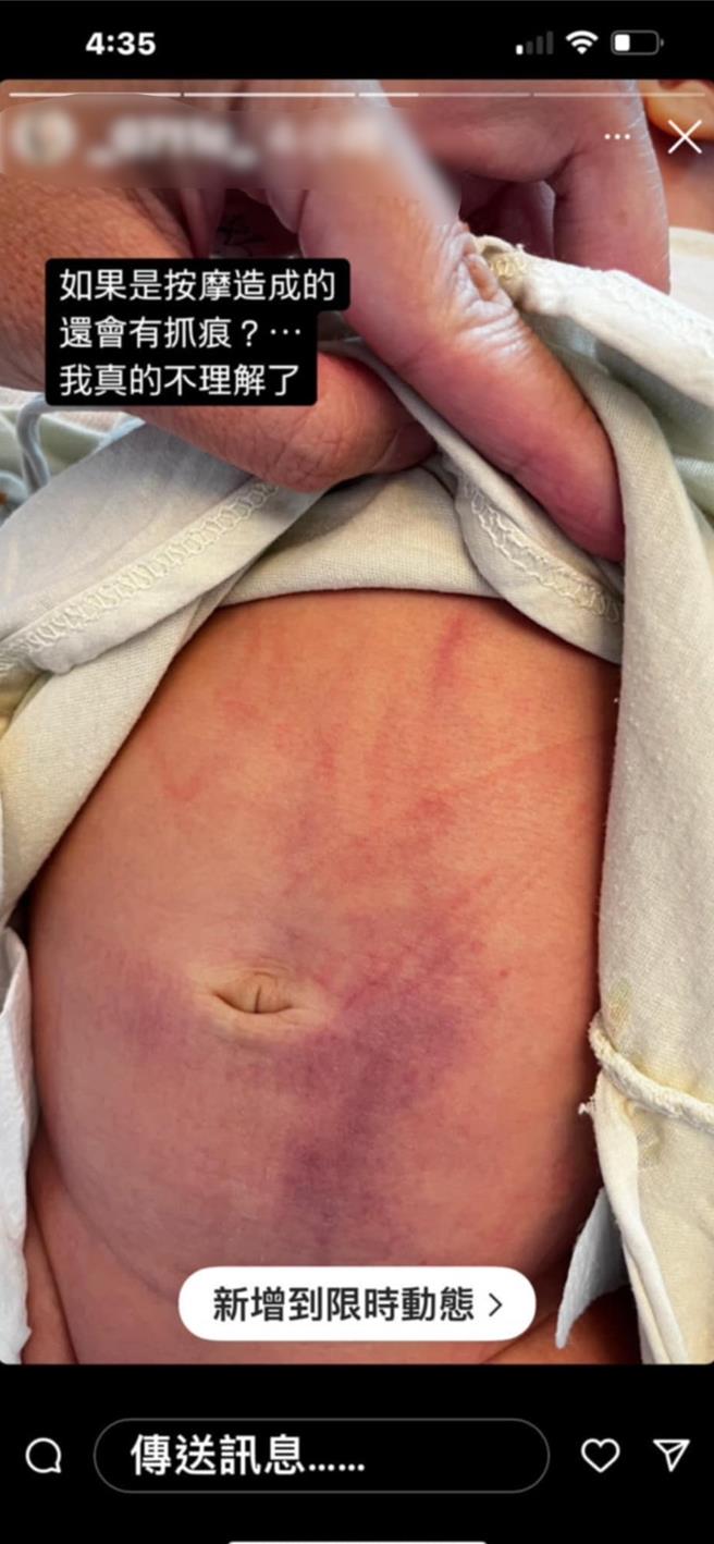 今(7日)家属出面指控月子中让宝宝受到伤害，不排除提告。(读者提供／吕妍庭嘉义传真)