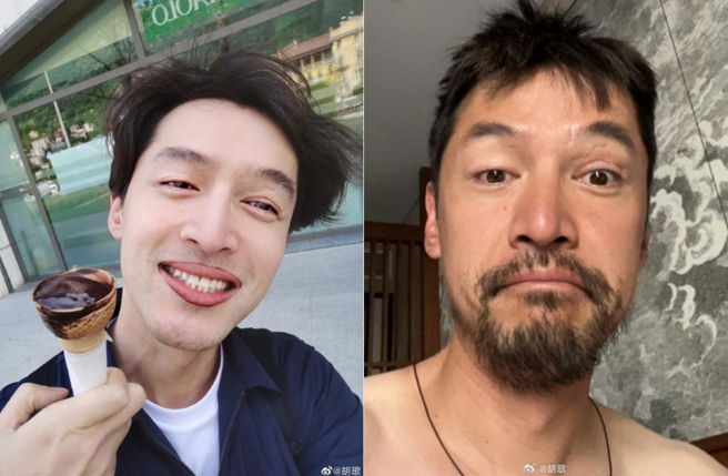 胡歌曾大方秀出脸上伤口。（图／翻摄自胡歌微博）