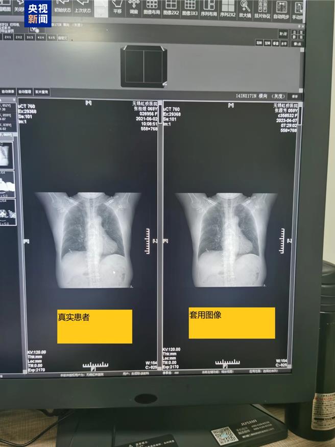 陸無錫虹橋醫院涉嫌違法違規詐領醫保基金逾億元。（大陸央視）
