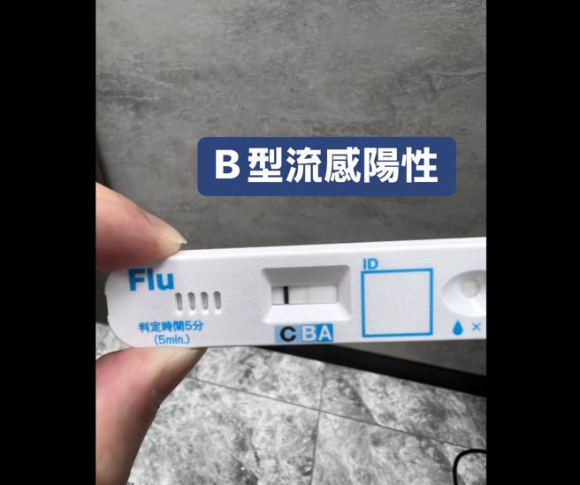 一名女子发烧又喉咙剧痛、吞咽困难到诊所就医，结果是得了B型流感。（翻摄自李典宪 耳鼻喉科医师脸书）