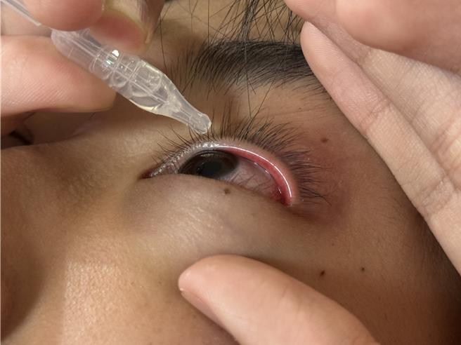 眼睛乾涩、疲劳是许多现代人的文明病。（曹婷婷摄）