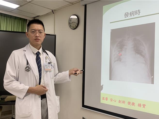 近期台中市70岁退休公务员出现咳嗽、微烧，3天后竟咳血，吓得就医，才发现是严重肺炎合併呼吸窘迫症，幸经治疗后顺利出院，台中医院胸腔内科医师王颛铨11日提醒入秋后好发呼吸道疾病应多注意。（潘虹恩摄）