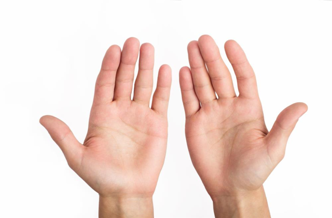 一名40岁女子因手掌变黄，以为是肝病引发黄疸而就诊，没想到最终检查竟确诊大肠癌第三期。（示意图：shutterstock／达志）