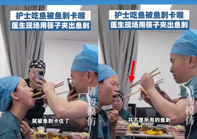 医护人员休息时间吃饭突然被鱼刺卡喉咙，旁边刚好是专科医生用筷子一秒夹出。（图／翻摄微博）