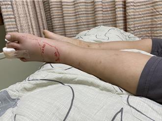 颱風後4起毒蛇咬傷案 衛生局提防護要點：勿徒手打蛇