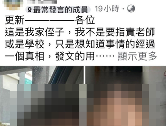 2歲男童臉頰紅腫瘀傷 監視器剛好故障！托嬰中心：清者自清