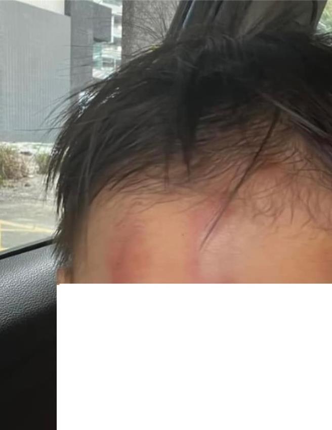 雲林縣虎尾鎮某托嬰中心1歲多男幼童，額頭2度出現瘀青情況，家長要求調閱監視器，卻被告知監視器網路線壞掉，17日縣社會處表示初步調查沒有虐童情況，但會釐清照護過程是否有疏失。（翻攝自虎尾人（讚）出來／張朝欣雲林傳真）