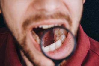 罹癌口腔先知道！醫揭4警兆：酸臭、白斑小心了