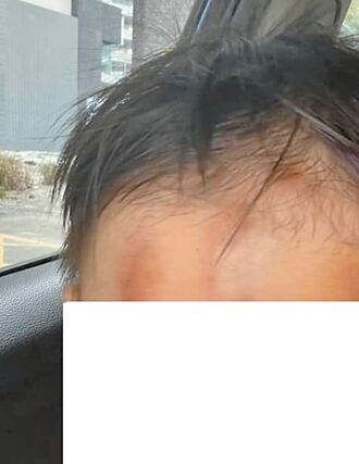 托育童滿頭包 雲林社會處追查