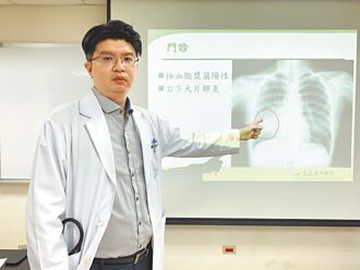 女大生赴日探親 染黴漿菌右肺變白