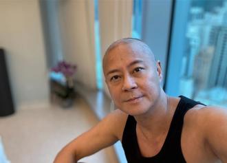 「草蜢」蔡一傑切除腦瘤 醫看巨疤照 揭發病2症狀