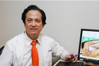 男子罹患白斑症臉出現「平躺的台灣」醫移植黑色素恢復膚色