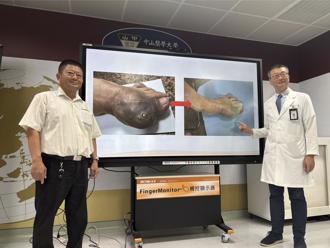 痛風不再是帝王病 高尿酸血症與心血管疾病息息相關