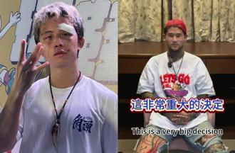 孫安佐被打到毀容「拆肋骨補鼻」？經紀人發聲了：痛苦的決定