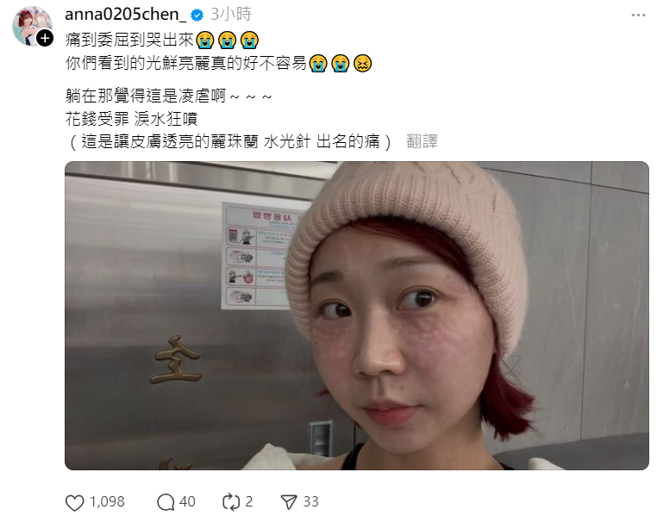 安娜脸上像极了荨麻疹，她透露打水光针痛到哭出来。（图／Threads@anna0205chen_）