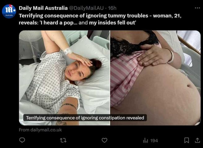 女子事后证实出现直肠脱垂问题。（图／翻摄自X）