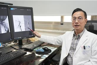 腦中風1警示症狀速就醫 4.5小時打通血管是關鍵