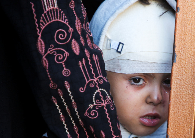 2024 年 10 月 30 日，在以色列與哈馬斯衝突期間，一名在以色列襲擊中受傷的巴勒斯坦男孩在加薩走廊南部汗尤尼斯。（路透社）