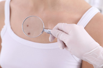 身上4顆痣最好別留 容易破財還招小人