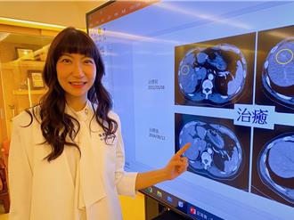 肝癌新疗法！结合免疫治疗与栓塞 患者存活率大幅提升