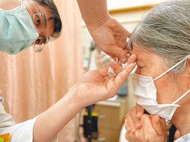 北榮傳統醫學部整合醫學科主任張清貿團隊，透過針刺治療改善乾眼症。（鄭郁蓁攝）