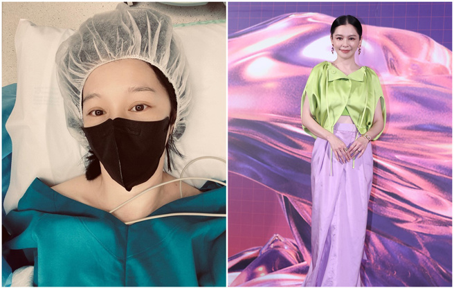 徐若瑄近年健康亮红灯。（徐若瑄脸书、中时资料照）