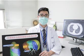 76歲高齡婦人逆轉命運！「冷凍微針」遠離肺癌復發