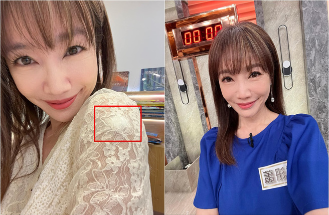 蕭彤雯曬照紀念第一次打公費新冠疫苗。（圖／蕭彤雯臉書）