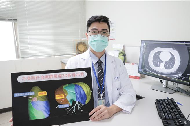 羅東博愛醫院胸腔外科醫師白楚彬表示，有別於過去的化療、開刀手術治療癌症，「多重治療」目前已成肺癌治療主流。（羅東博愛醫院提供／吳佩蓉宜蘭傳真）