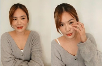 陳沂神隱3個月終露面！眼神怪怪的 自爆動手術「狀況沒有很好」