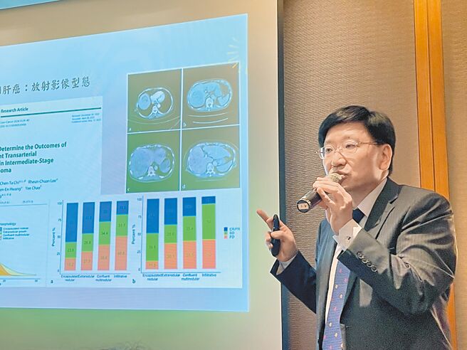 台灣肝癌醫學會理事長黃怡翔講座教授近年的研究發現「7-11準則」，作為中期肝癌治療的依據。（鄭郁蓁攝）