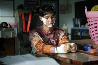 泰男神為戲遭榴槤砸傷 見血後嚇到暈過去