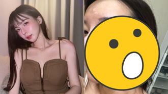 奎丁「素顏脸烂」真面目曝光！坑坑疤疤判若两人网吓坏