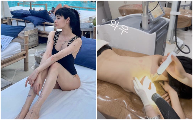 南韩女星Nana全身都是刺青，为了让母亲安心，她近日将全身刺青清除。（图／摄自YT@NA(     )NA、IG@jin_a_nana）