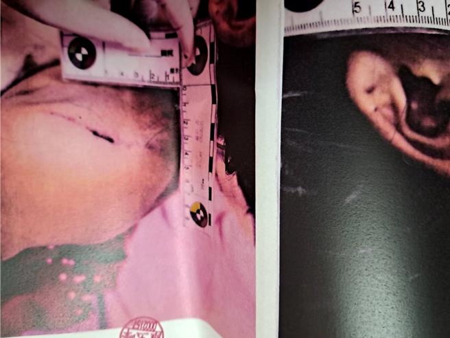 云林县7岁女童遭邻居秋田犬攻击，头、脸被咬破全身是血，送医后捡回一条命，事后女童心里产生严重阴影，但秋田犬饲主却不闻不问，女童母亲气不过，决定对饲主提告。（民眾提供／张朝欣云林传真）