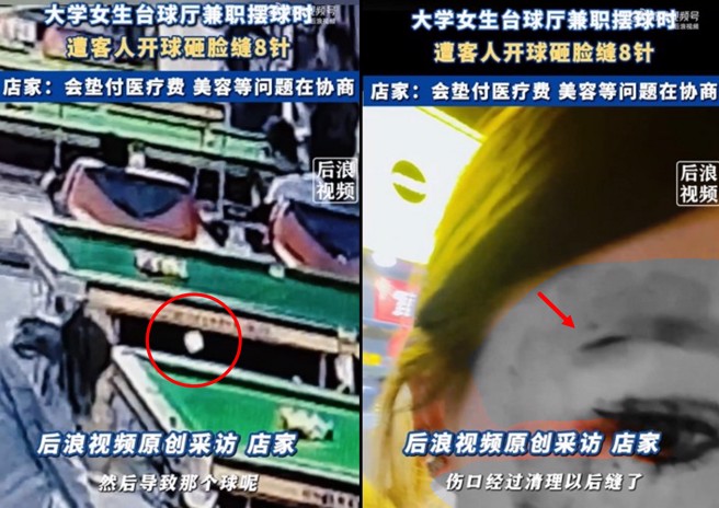 大陆一名女大生在撞球店打工，遭客人击球撞伤脸部当场破相。（图／翻摄微博）