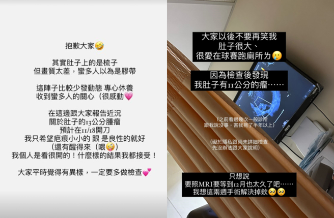 陈波波宣布18日动手术曝身体近况。（图／IG@bobo.0715）