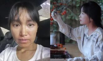 李子柒新片吸1.4亿观看 制漆器严重过敏 脸包纱布肿成「电视机」
