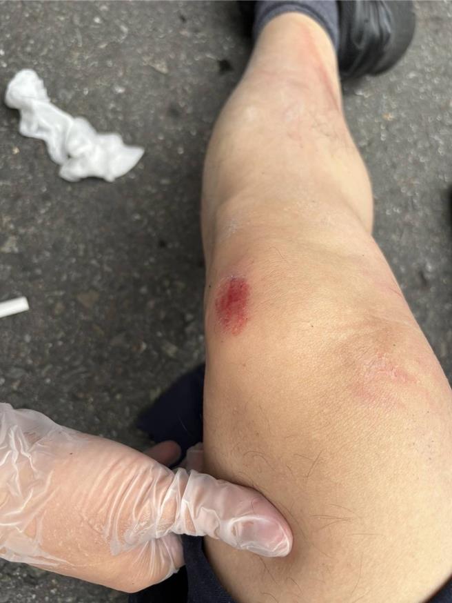 警方表示，遭拖行2名員警僅手腳擦挫傷，經送醫檢查後沒有大礙。（警方提供／任義宇高雄傳真）