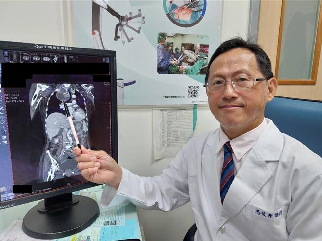 苗栗縣大千綜合醫院外科部主任馮啟彥表示，甲狀腺腫瘤過大或癌變，建議採取手術治療。（大千醫院提供／謝明俊苗栗傳真）