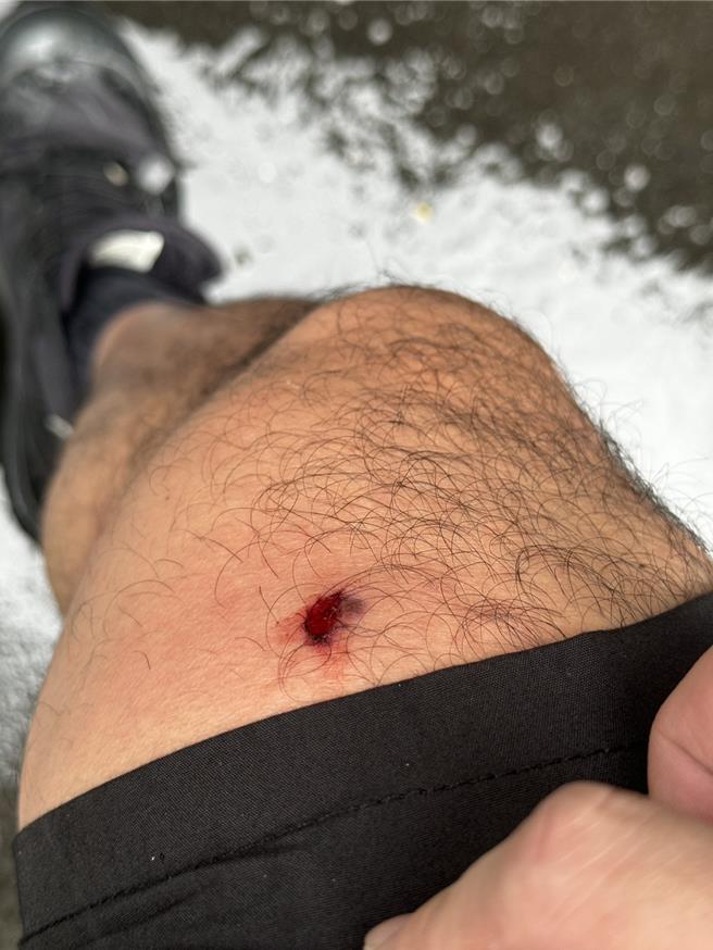 员警李文栋的右大腿遭弹壳反弹受伤。（翻摄照片／林郁平台北传真）