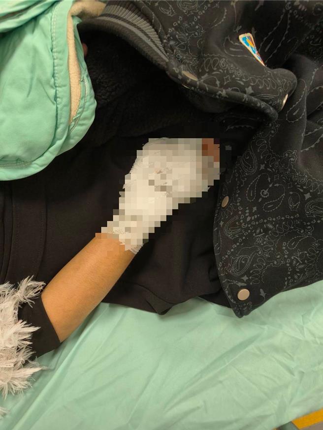 林女遭槍枝誤擊，右手掌被貫穿。（警方提供）